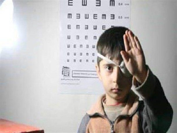 طرح غربالگری تنبلی چشم در ۱۲ پایگاه بروجرد آغاز شد