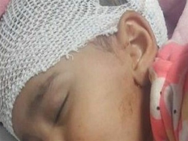 حمله سگ های وحشی در ورزنه، چهار کودک را راهی بیمارستان کرد/ تصاویر