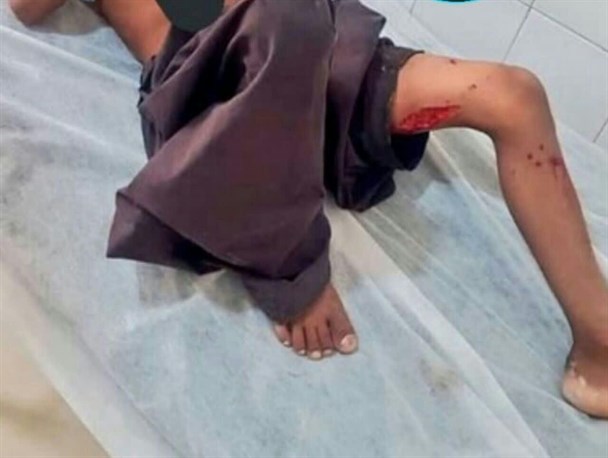 ​حمله مجدد گاندوها به یک‌کودک در چابهار