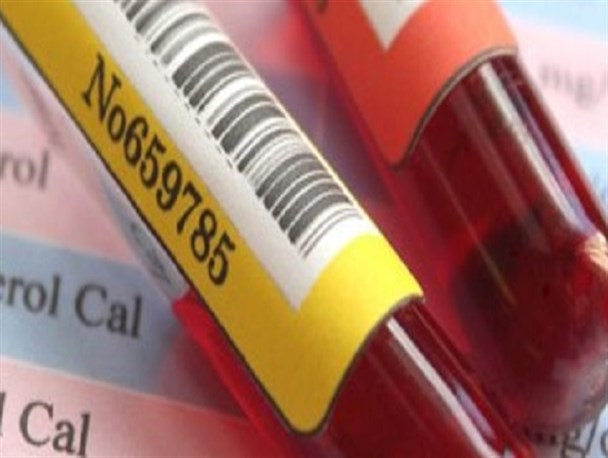 میزان نرمال HDL در آزمایش چقدر است؟