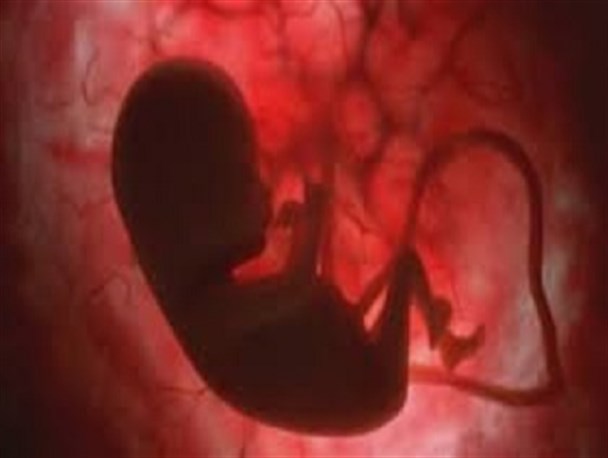 بیش از هزار نمونه خون بند ناف در قزوین ذخیره شده است