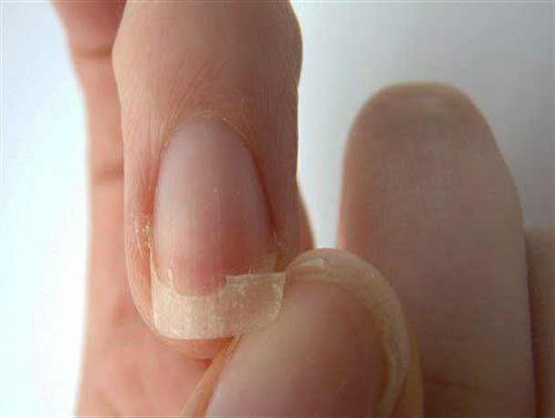علت شکنندگی ناخن‌ها را بدانید