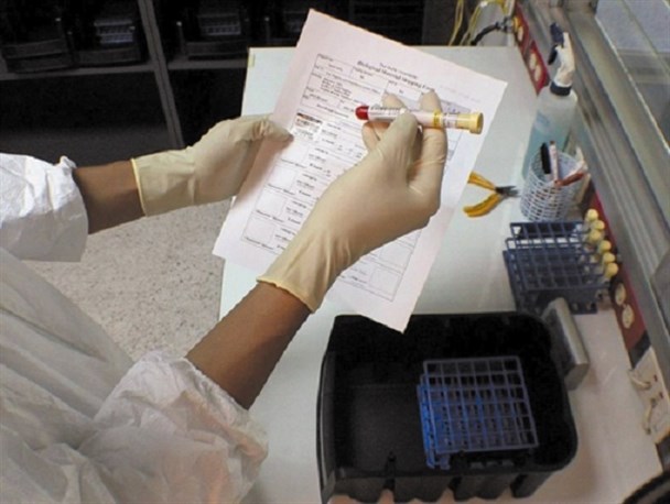 ۹۷ نفر از معتادان اسدآباد آزمایش ایدز دادند