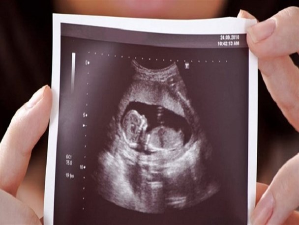 هزینه‌های درمان نازایی تحت پوشش بیمه‌ سلامت قرار گرفت