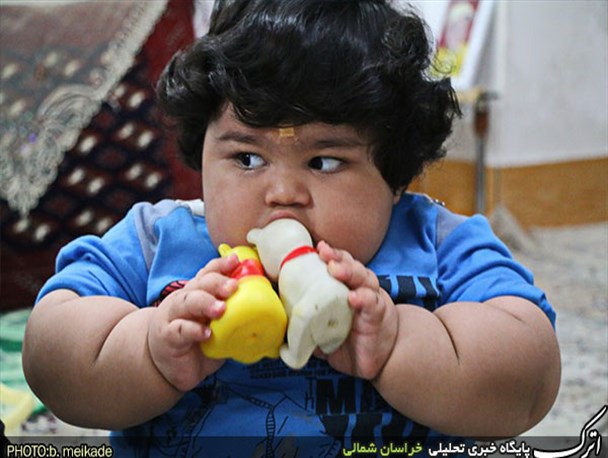 کودک 15 ماهه بجنوردی با 42 کیلو وزن + تصاویر