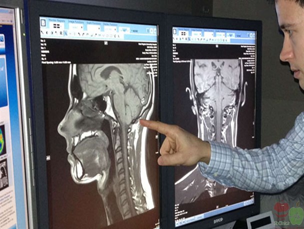 رادیوگرافی، سی‌تی اسکن مغز و MRI ستون فقرات در صدر آمار تصویربرداری های پزشکی در فارس