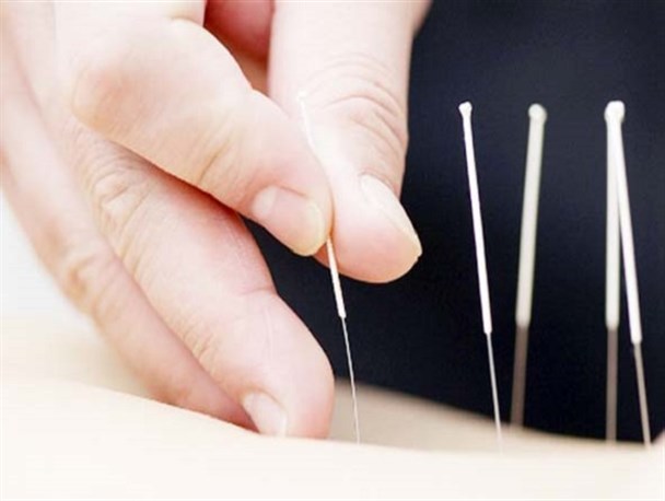 برگزاری دوره‌های جدید آموزش طب سوزنی در پژوهشکده اسلام و سلامت پایدار