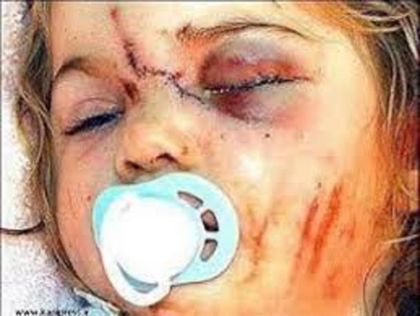 کودک آزاری یک مسئله فرهنگی اجتماعی و پزشکی است