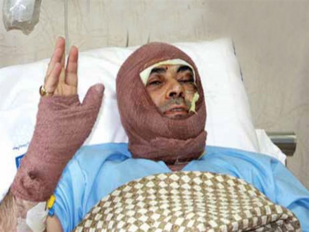 دستگیری عوامل اسیدپاشی ساختگی در تبریز