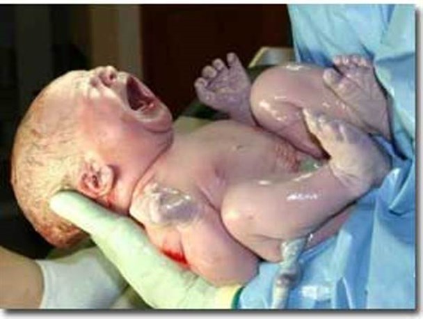 کاهش 20 درصدی سزارین باراول در کهگیلویه و بویراحمد