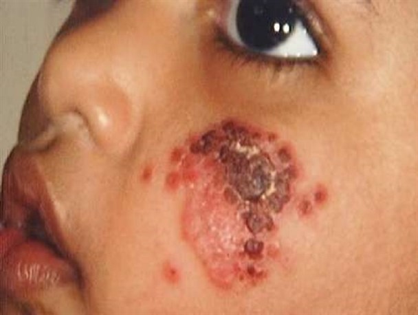 آمار تکان دهنده ی پیشرفت سالک در آبدانان