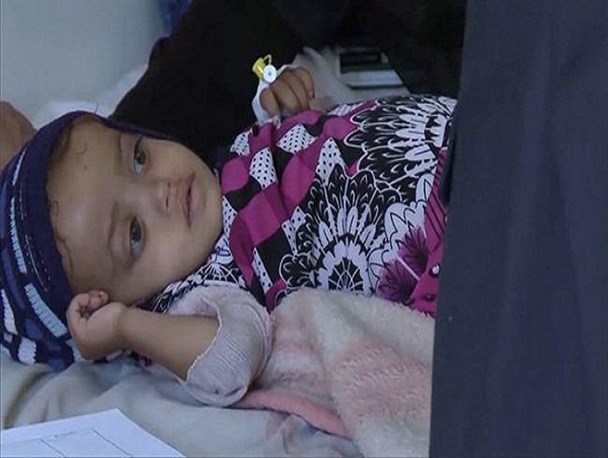 سازمان ملل: روزانه 113 یمنی به دلیل محاصره جان خود را از دست می دهند
