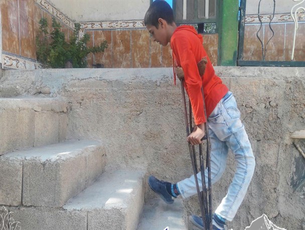 نوجوان کهگیلویه و بویراحمدی با معلولیتی شگفت انگیز در دنیا / شاهین همچنان در انتظار کمک خیرین کشور + تصاویر