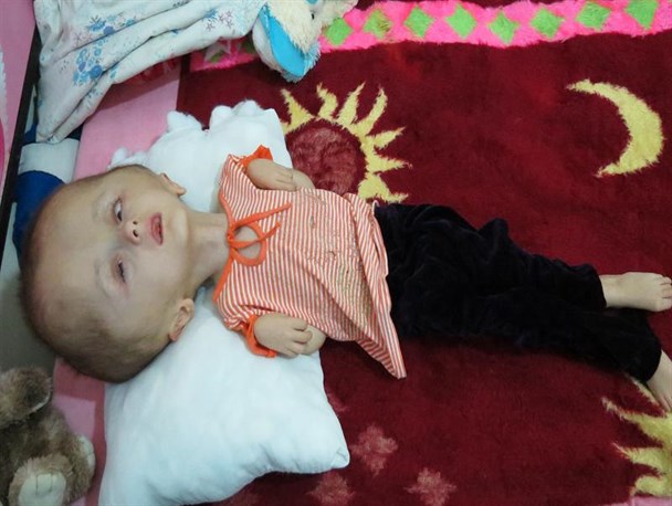 سونیا دختر 9 ساله دهگلانی چشم انتظار کمک هم نوعان است