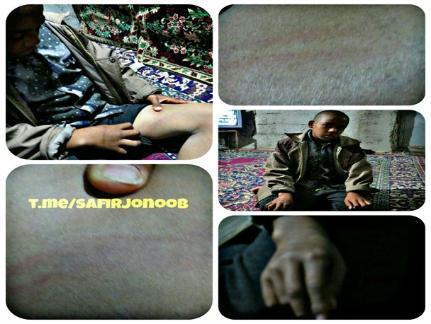 ضرب و شتم  بی رحمانه دانش آموز توسط معلم عنبرآبادی