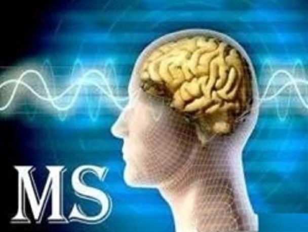 ۱۱۰۰ نفر در استان اردبیل مبتلا به بیماری ام اس هستند