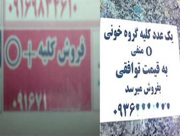 خرید و فروش کلیه در بازار سیاه دلالان
