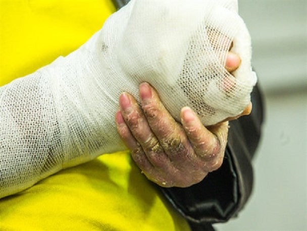 ۳۲۱۵ بیمار نادر در کشور/ تامین داروی بیماران، تحت تاثیر تحریم‌ها