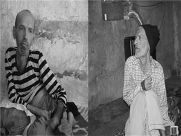 قصه پر غصه دو برادر معلول، علی و نادعلی+تصاویر/نمی دانم بعد از مادرم چه سرنوشتی در انتظار ماست