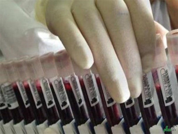 ذخیره بیش از 80 نمونه در بانک خون بندناف جهاد دانشگاهی خراسان جنوبی