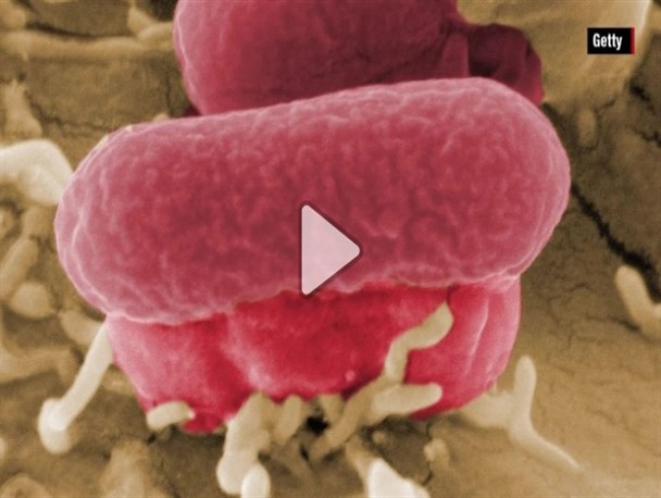 5 کشته و انتشار 197 نوع بیماری در پی شیوع ویروس (E. coli) در آمریکا