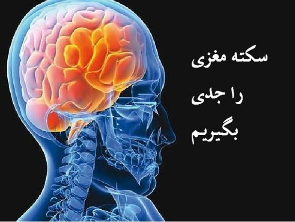 3 ساعت اولیه بروز علائم سکته مغزی، زمان طلایی برای جلوگیری از مرگ مبتلا است
