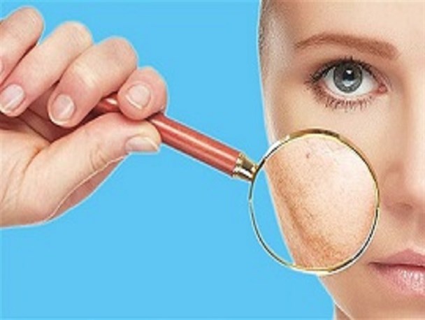 تاثیر آلودگی هوا بر پوست/  ویتامین C، سلاحی قوی در مبارزه با رادیکال های آزاد