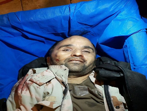 عکس منتشر نشده از لبخند شهید نامدار صنوبری در حین شهادت