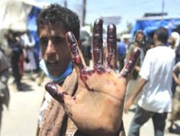 هیچ کشوری در دنیا حق ندارد که حاکمیت یمن را نقض کند