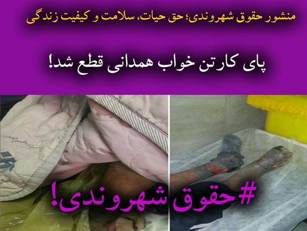 حقوق شهروندی کجا و قطع شدن پای کارتن‌خواب همدانی کجا!