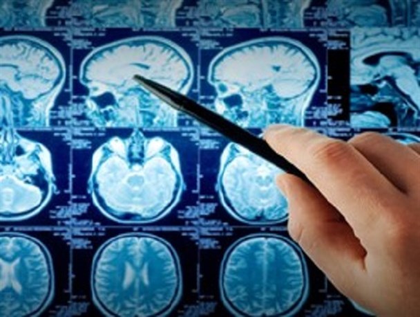 منابع حاصل از حذف ارز ۴۲۰۰ تومانی صرف کاهش هزینه درمان شود