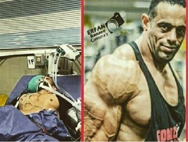 رژیم غذایی نادرست قهرمان پرورش اندام کارونی را به کما برد