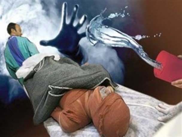 اسیدپاشی ناگهانی به صورت مرد جوان در صومعه سرا