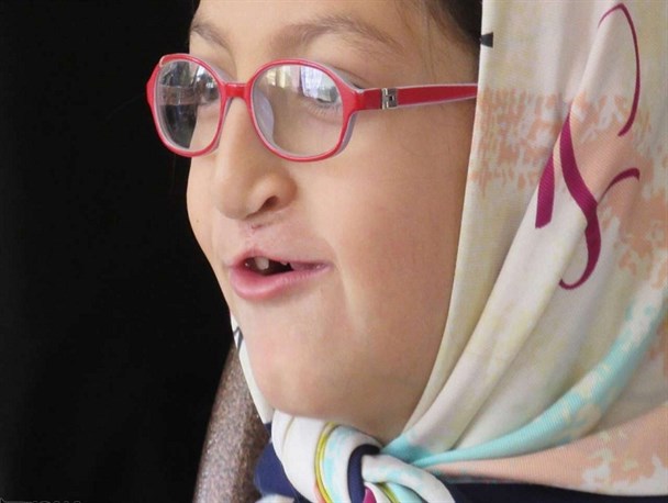 پزشکان گروه مرهم در حال نشاندن لبخند بر چهره لب شکری ها