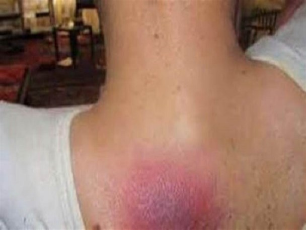 زخم بی تدبیری بر پیکر 8 معلول مینابی/نهادهای عمومی مناسب سازی معولان نیست