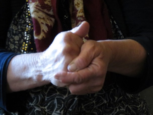 دستان سرد چند«کبری خانم» گرمای محبت خیران را طلب می کند+تصاویر