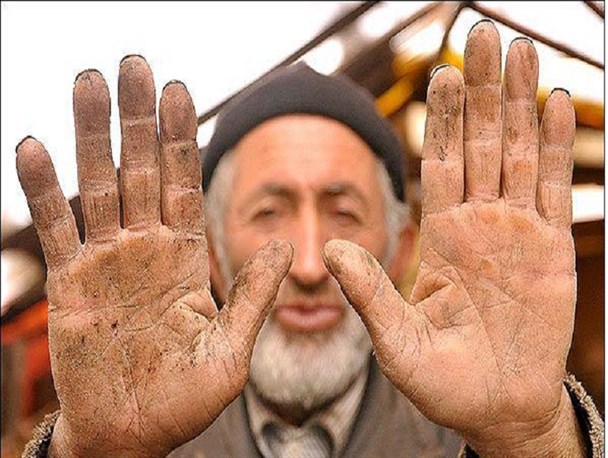 کسی داروی جدیدی برای دستان پینه بسته سراغ دارد؟