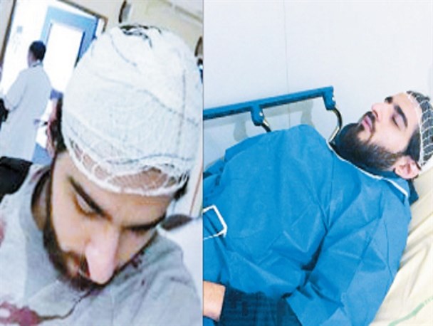 فرانسه آزادی را به کما برد، سلبریتی‌ها را به خفقان!