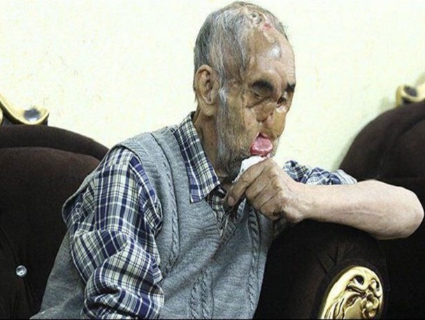 درد رجب دولت بی‌دردهاست – صورت او زخمی نامردهاست