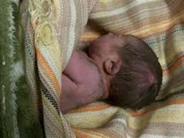 مرگ نوزاد در حین زایمان ،سهل انگاری پزشک یا بازهم امری طبیعی