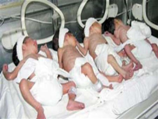 تولدچهارقلوهااز مادری26سال درهمدان