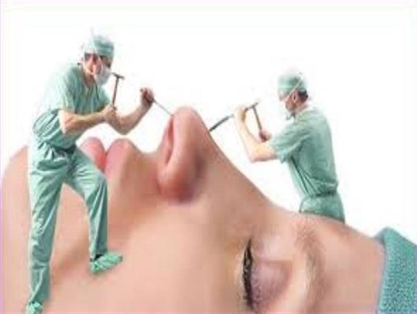 مدگرایی، چشم و هم چشمی و نیاز به توجه از سوی دیگران از مهمترین علل جراحی‌ زیبایی است