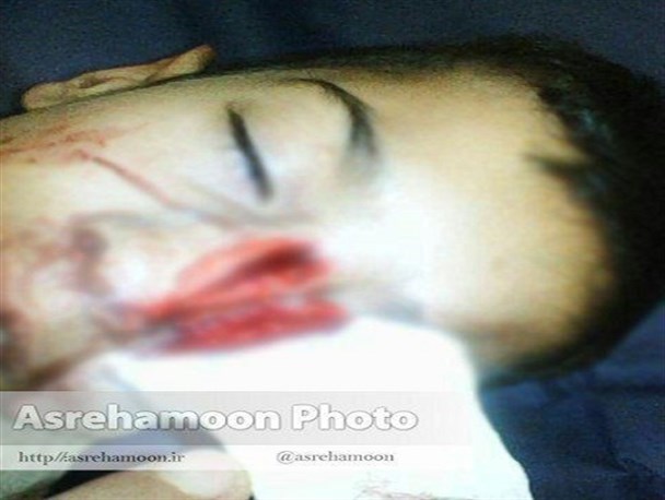 شکستگی بینی و ۲۰ دقیقه بیهوشی دانش آموز زاهدانی در مدرسه