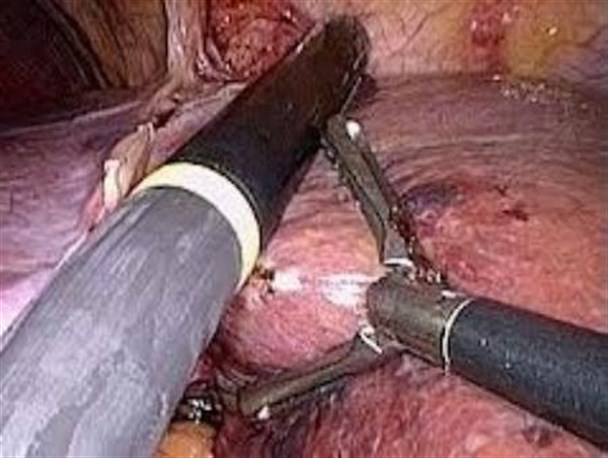 اجرای طرح تلقیح مصنوعی گوسفند به روش لاپاراسکوپی برای اولین بار در بهاباد