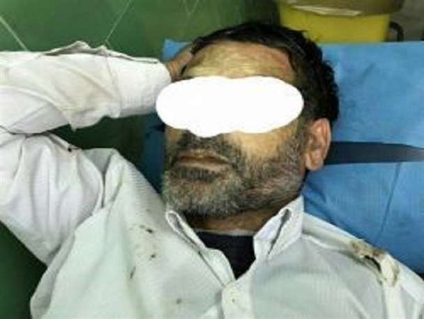 اسیدپاشی در پارس‌آباد/ عامل اسید پاش دستگیر شد
