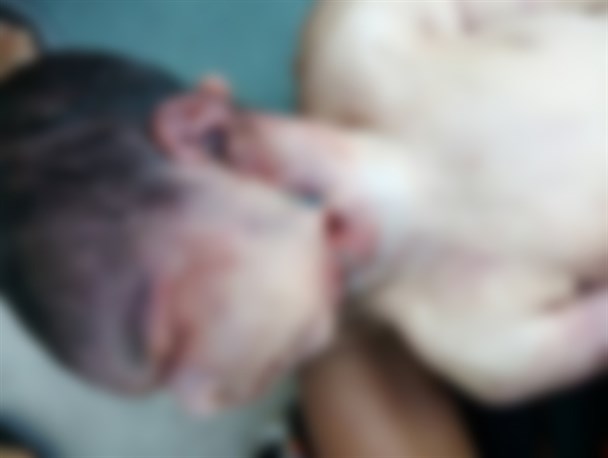 پدر نوزاد: سر فرزندم حین تولد از تنش جدا شده است/ سرپرست دانشکده علوم پزشکی: نوزاد در شکم مادر فوت شده بود+ تصاویر
