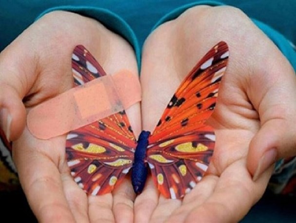 پیله‌هایی از جنس تاول و زخم‌هایی که پایان ندارد/ فوت بیماران پروانه‌ای به دلیل کمبود پانسمان