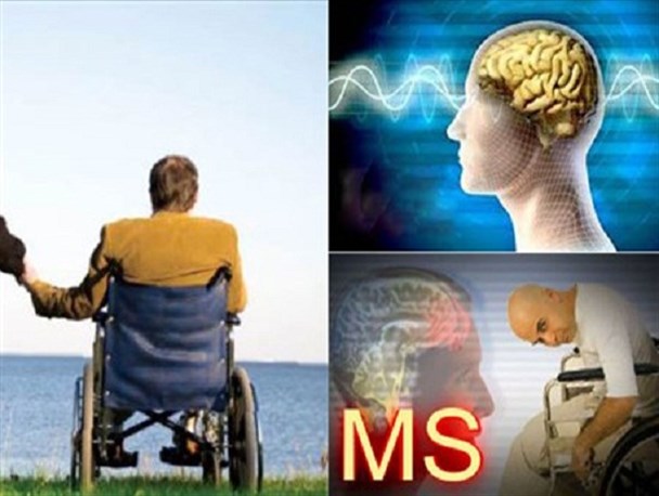 بیماران ام اس و دیالیزی خراسان شمالی رو به افزایش است/تالاسمی کنترل شد