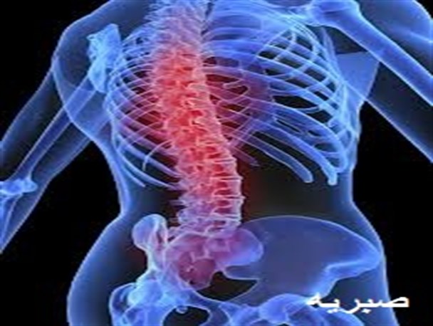 دریافت نور آفتاب و تغذیه مناسب و ورزش باعث کاهش انحرافات ستون فقرات می شود