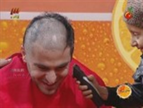 کچل شدن علی ضیاء برای همدردی با کودک سرطانی+عکس